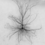 Pig Neurons in Human Brains? The 2025 Reality Check on Neuron Xenotransplantation—Breakthroughs, Risks, and What Happens Next
