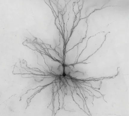 Pig Neurons in Human Brains? The 2025 Reality Check on Neuron Xenotransplantation—Breakthroughs, Risks, and What Happens Next