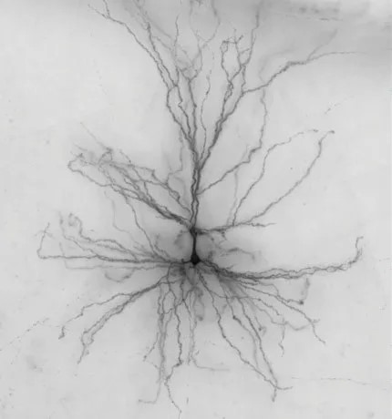 Pig Neurons in Human Brains? The 2025 Reality Check on Neuron Xenotransplantation—Breakthroughs, Risks, and What Happens Next